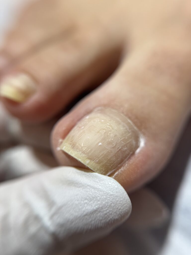 ﻣﺪﻟﺴﺎزی ﻧﺎﺧﻨﻬﺎی ﭘﺎ