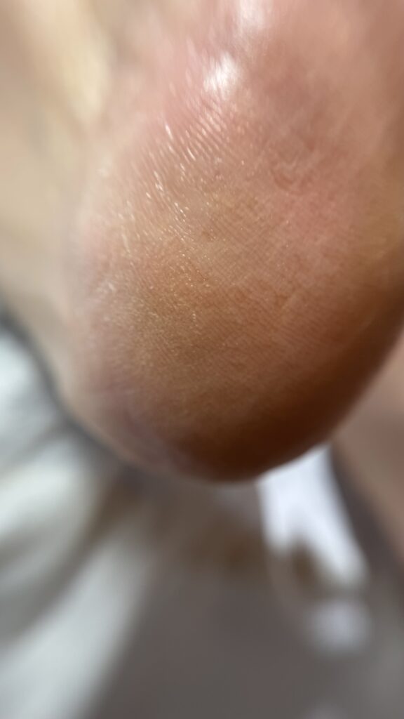 پدیکور درمانی