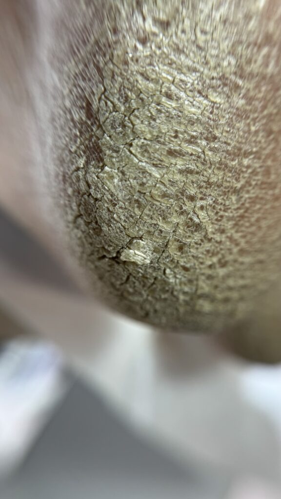 پدیکور درمانی