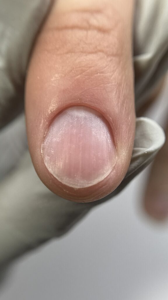 ﻣﺎﻧﯿﮑﻮر ﺑﺪون ﭘﻮﺷﺶ