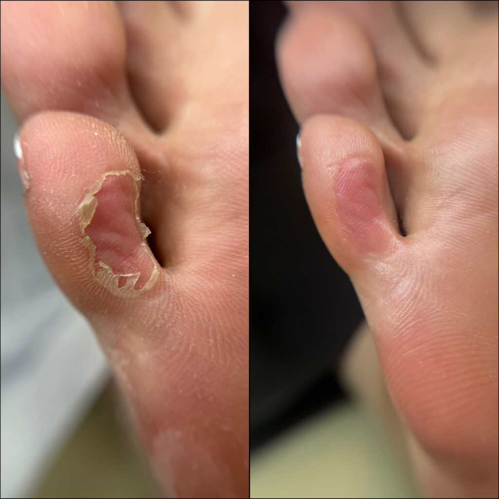 نمونه پدیکور درمانی