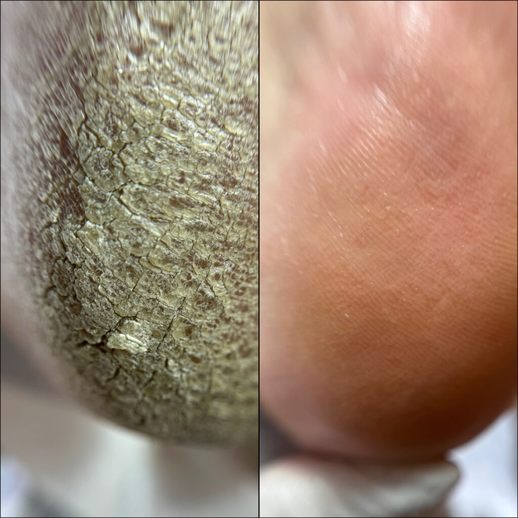 نمونه پدیکور درمانی