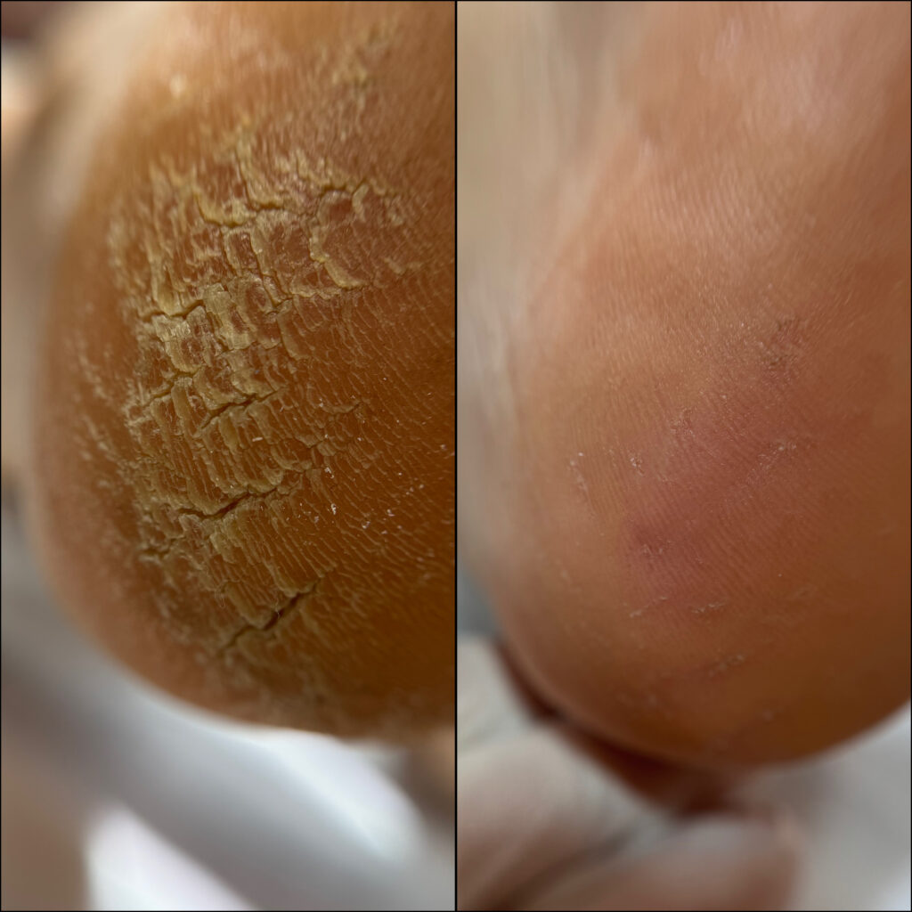 نمونه پدیکور درمانی