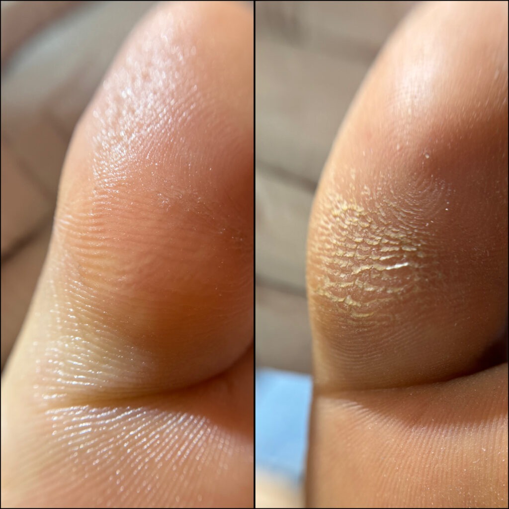 نمونه پدیکور درمانی