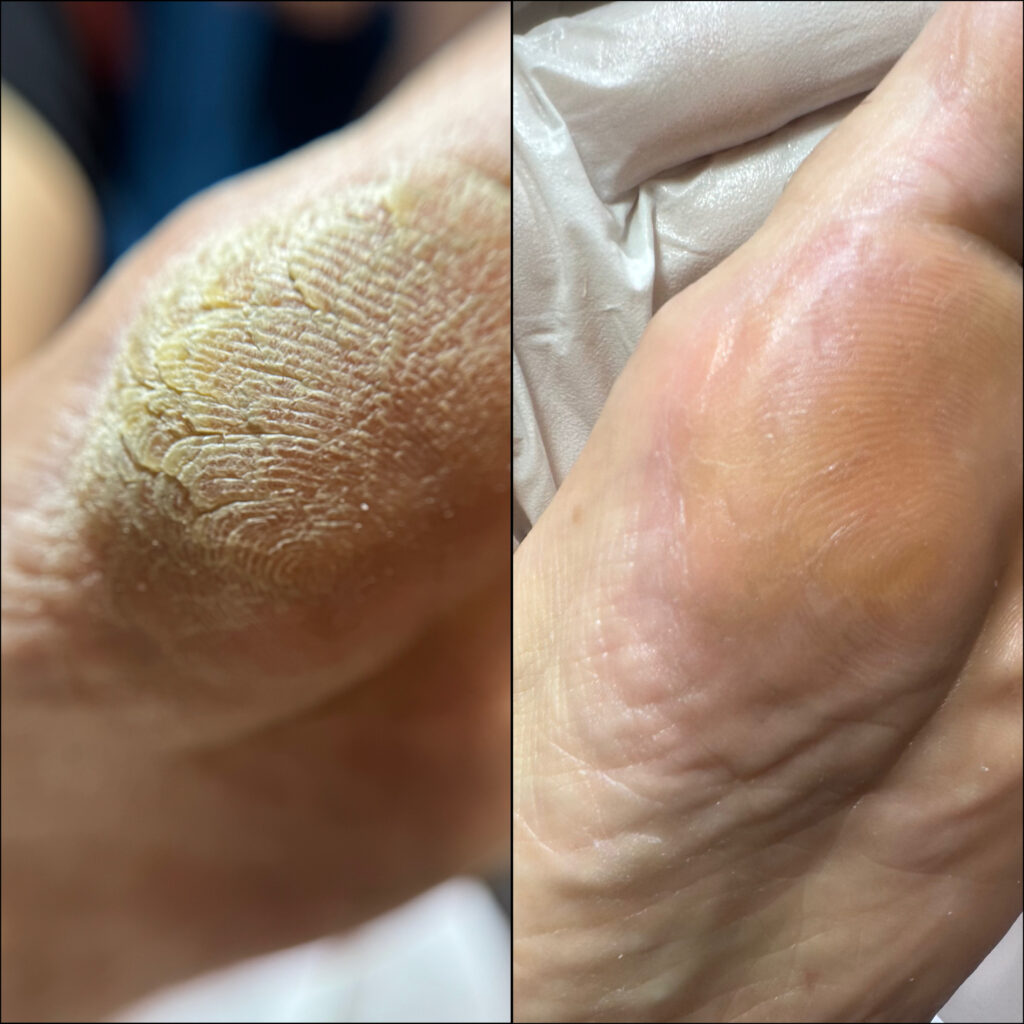 نمونه پدیکور درمانی