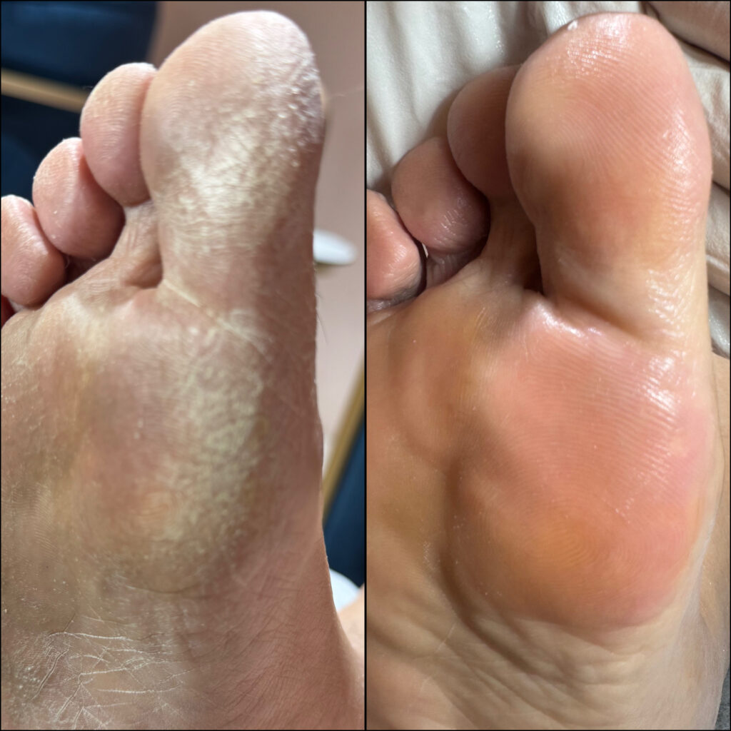 نمونه پدیکور درمانی